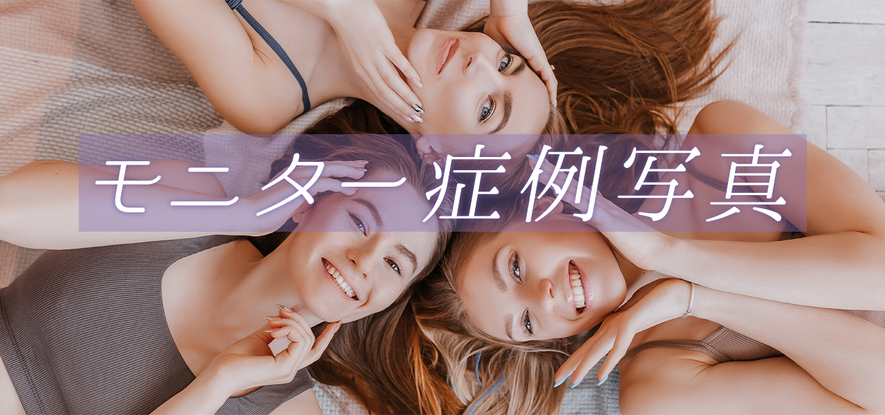 モニター症例写真